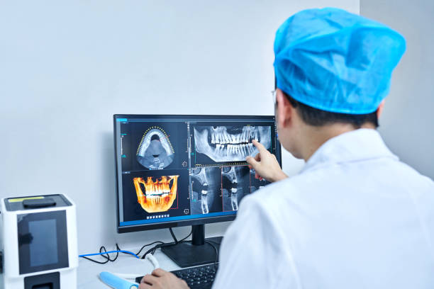 Best Emergency Wisdom Teeth Removal in Lake Isabella, MI